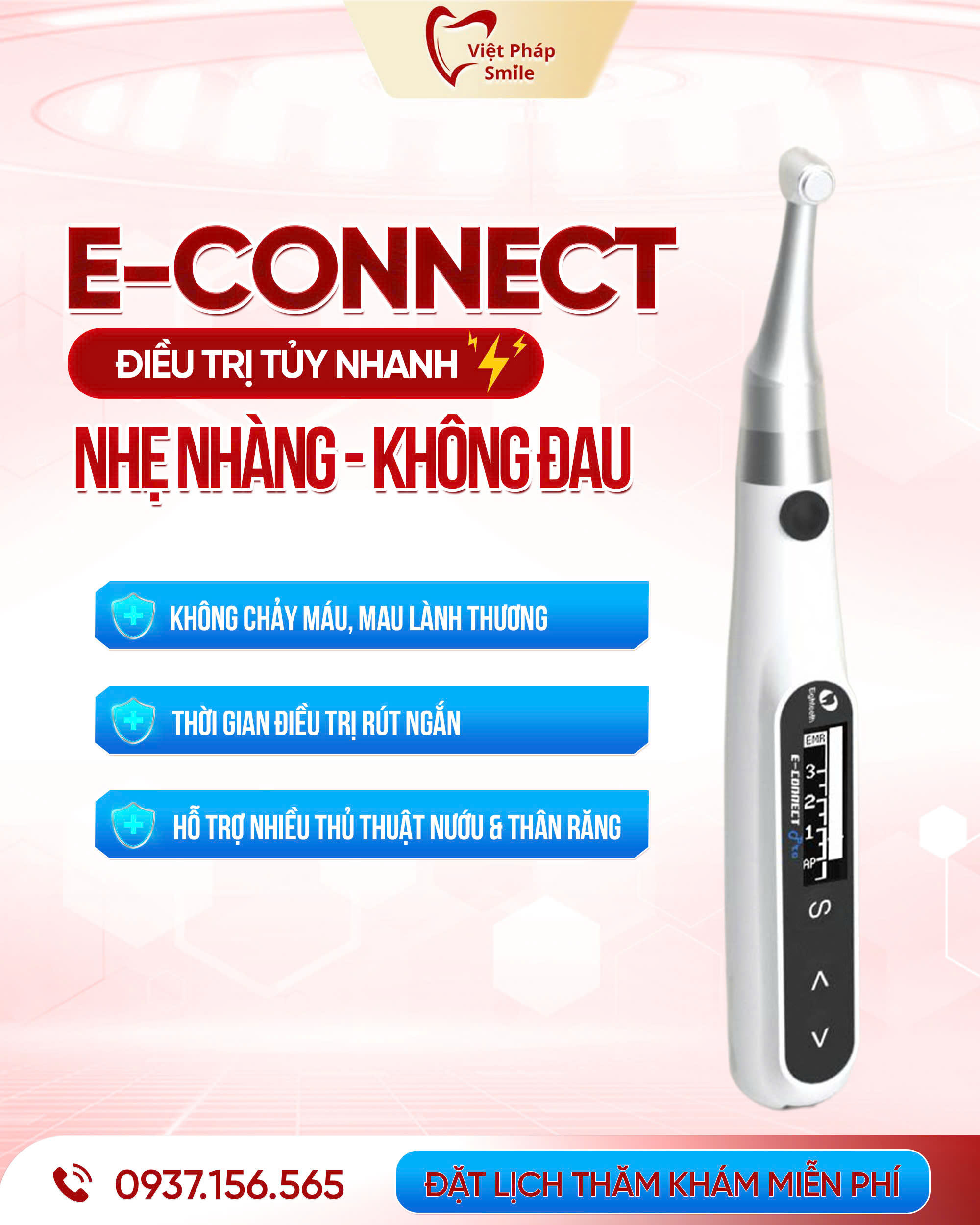 Trang thiết bị nha khoa 19 mau-dieu-tri-tuy-e-connect
