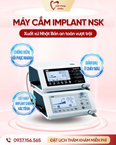 Nha khoa Quận 12 - Vì sao Nha Khoa Việt Pháp Smile được đánh giá cao tại Quận 12? 8 may-cam-implant