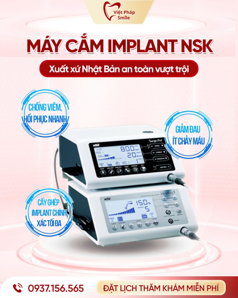 may-cam-implant