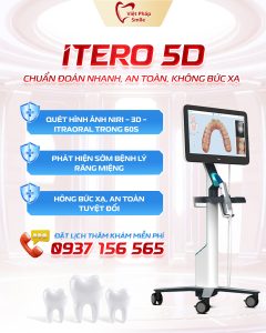 Nha khoa Quận 12 - Vì sao Nha Khoa Việt Pháp Smile được đánh giá cao tại Quận 12? 10 may-quyet-dau-rang-itero-5d