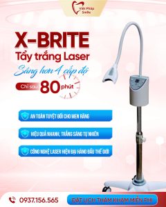 Nha khoa Quận 12 - Vì sao Nha Khoa Việt Pháp Smile được đánh giá cao tại Quận 12? 6 may-tay-trang-rang-x-brite