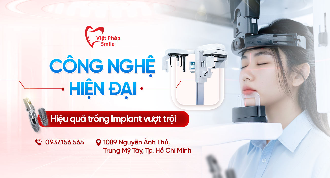 Trồng răng Implant tại Phường Trung Mỹ Tây (Quận 12 cũ): Nên chọn nha khoa nào để an tâm lâu dài? 2 cong-nghe-trong-rang-implant-hien-dai