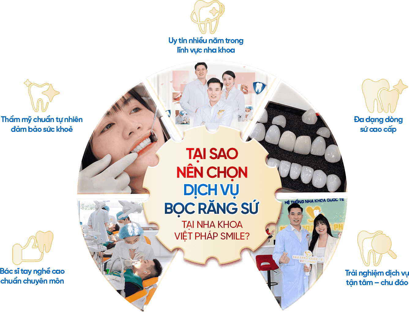 uu diem nha khoa min optimized 1