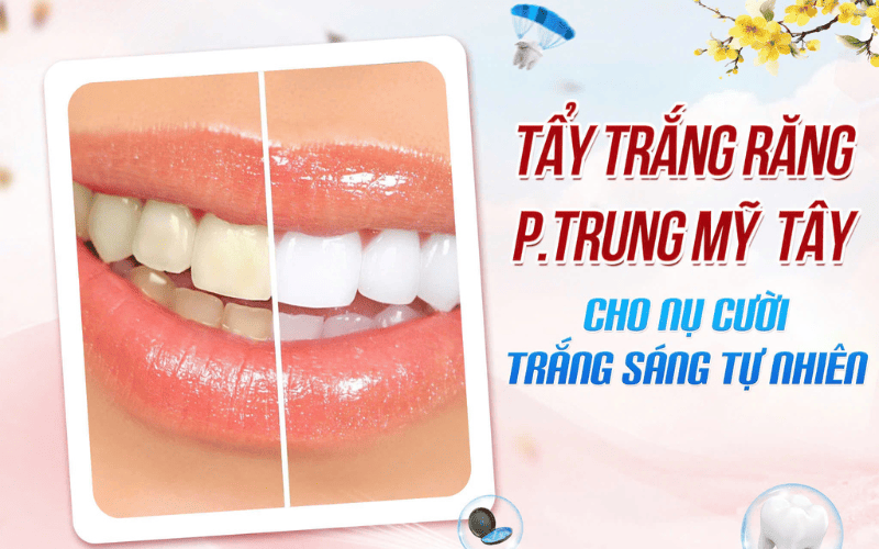 Tẩy trắng răng phường Trung Mỹ Tây – Cho nụ cười trắng sáng tự nhiên