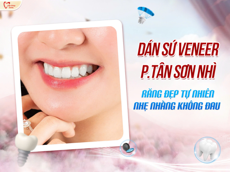 Dán sứ Veneer phường Tân Sơn Nhì
