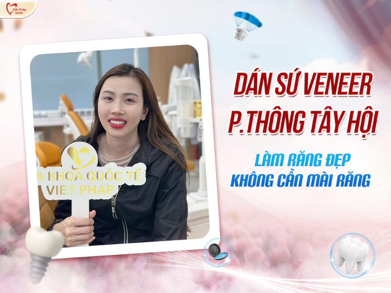 Dán sứ Veneer phường Thông Tây Hội – Làm răng đẹp không cần mài răng 1 Dán sứ Veneer phường Thông Tây Hội