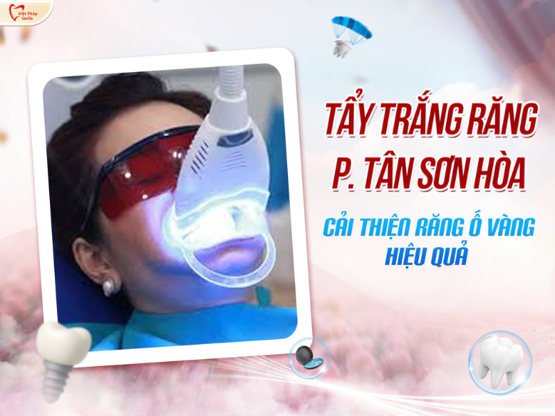 Tẩy trắng răng phường Tân Sơn Hòa – Cải thiện răng ố vàng hiệu quả