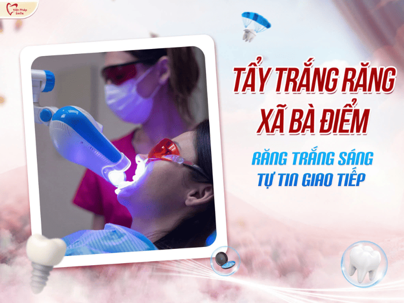 Tẩy trắng răng xã Bà Điểm – Răng trắng sáng, tự tin giao tiếp