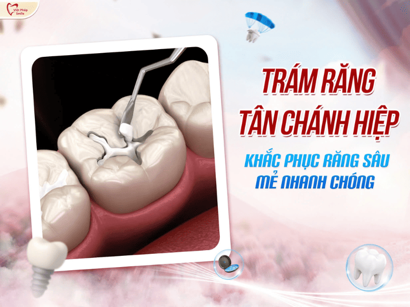 Trám răng phường Tân Chánh Hiệp – Khắc phục răng sâu, mẻ nhanh chóng