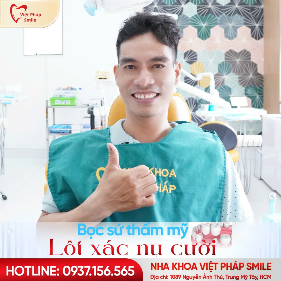 Bọc răng sứ phường Hạnh Thông – Răng sáng đẹp, bền chắc theo thời gian 5 boc-su-tham-my