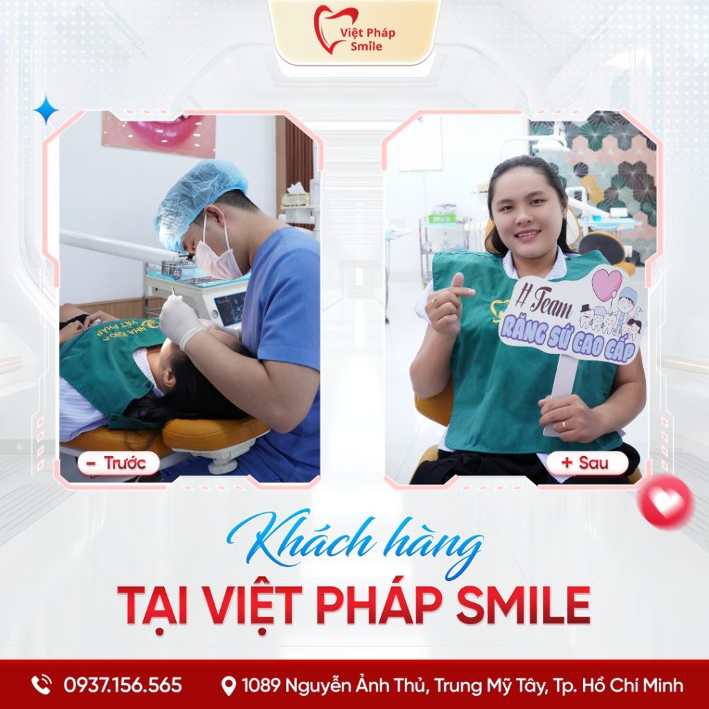 Bọc răng sứ phường Tây Thạnh – Giải pháp thẩm mỹ răng bền đẹp 2 boc-su-tham-my-10