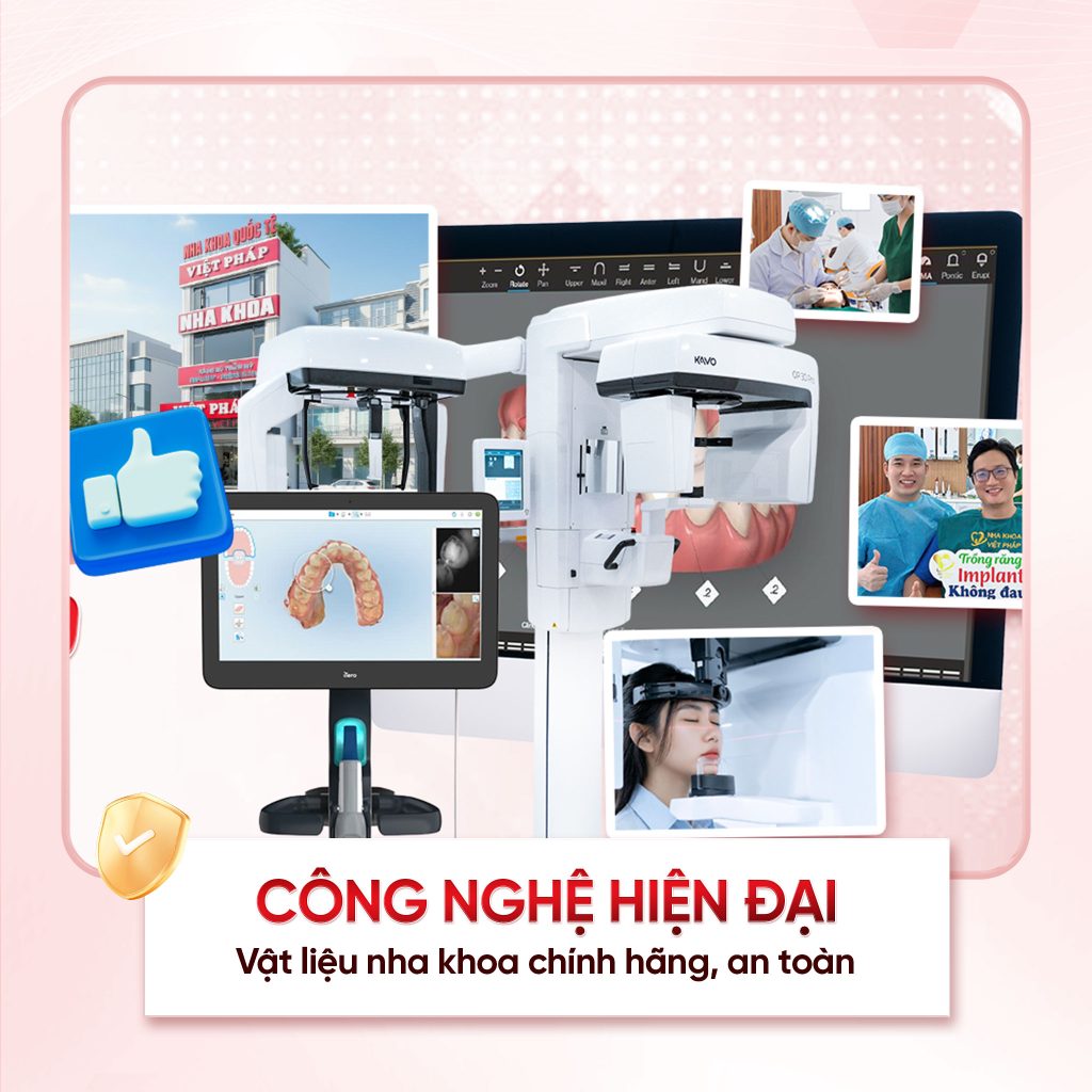 Tẩy trắng răng phường Tân Sơn Hòa – Cải thiện răng ố vàng hiệu quả 4 nha-khoa-viet-phap-smile-uu diem 2