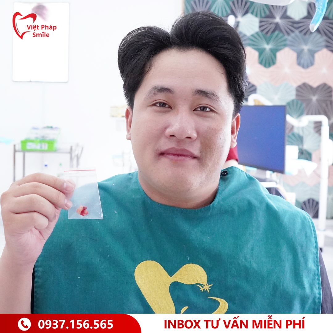 Nhổ răng khôn xã Tân Thới Nhì – An toàn, ít đau, hồi phục nhanh 3 nho-rang-khon-khong-dau-1