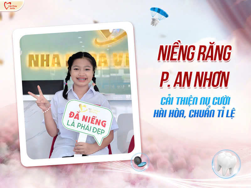 Niềng răng phường An Nhơn