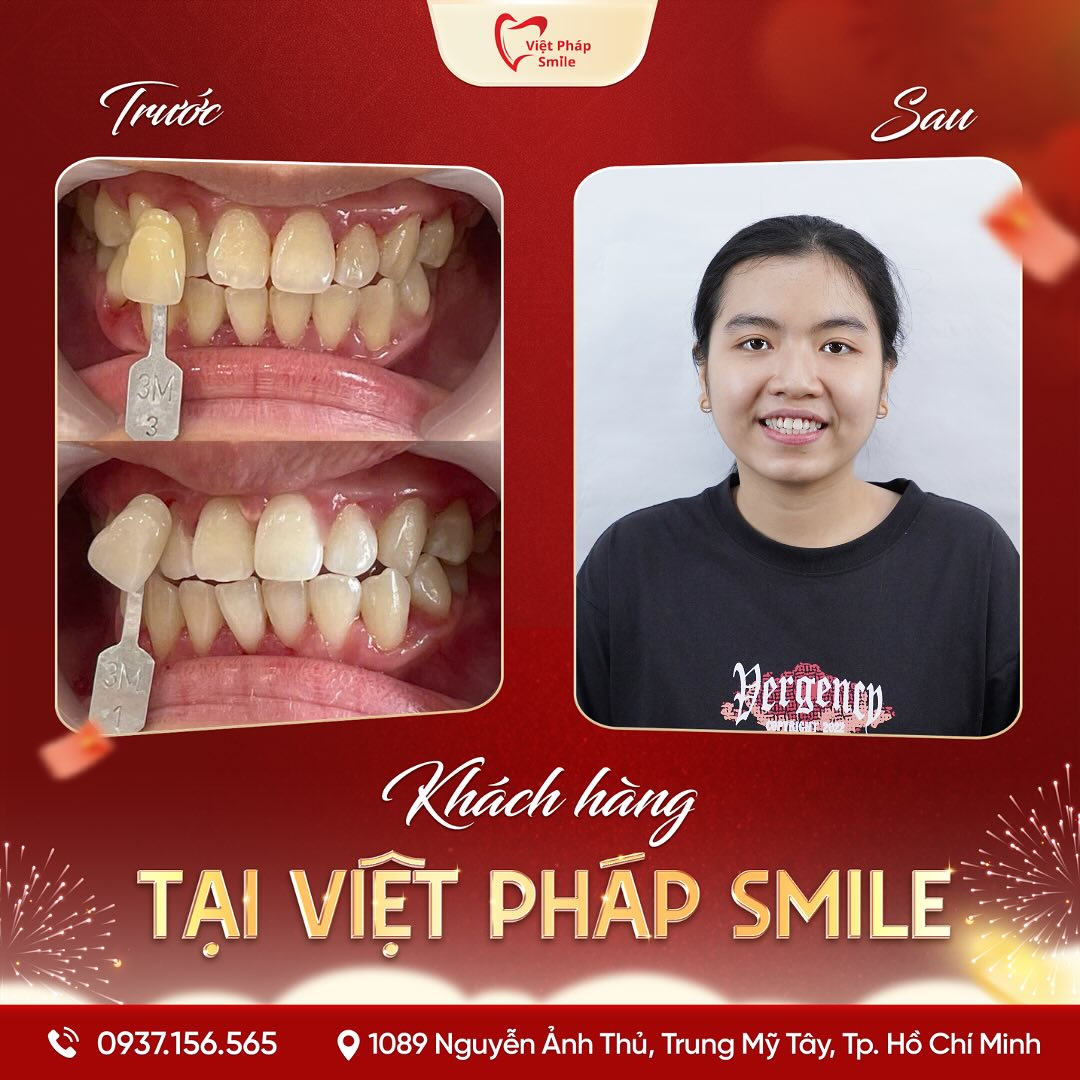 Thạc Sĩ – Bác Sĩ Văn Hồng Phượng 6 tay-trang-rang-1