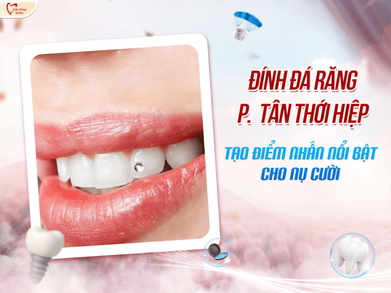 Đính đá răng phường Tân Thới Hiệp – Tạo điểm nhấn nổi bật cho nụ cười 1 Đính đá răng phường Tân Thới Hiệp – Tạo điểm nhấn nổi bật cho nụ cười