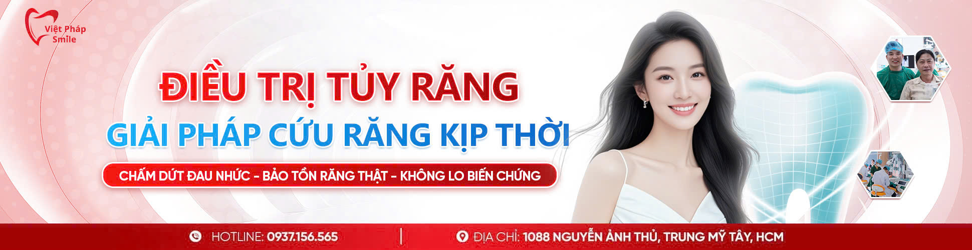 Điều trị tủy 1 dieu-tri-tuy-rang-nha-khoa
