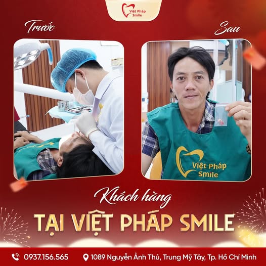 Nhổ răng thường, răng sữa 9 nho-rang-thuong-kh-2