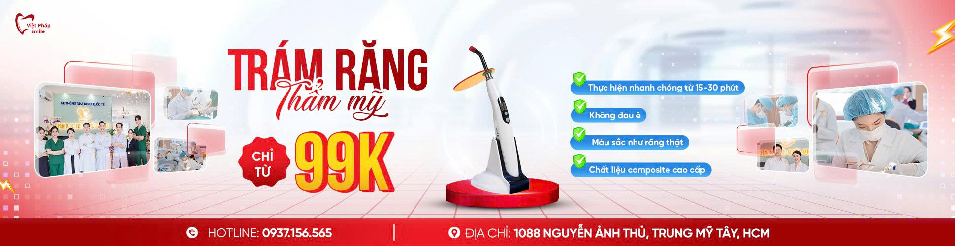 Trám răng thẩm mỹ 1 tram-rang-tham-my-banner