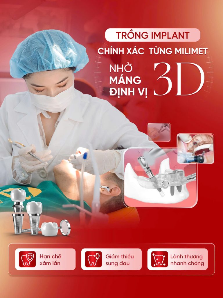 CÔNG NGHỆ IMPLANT HIỆN ĐẠI
