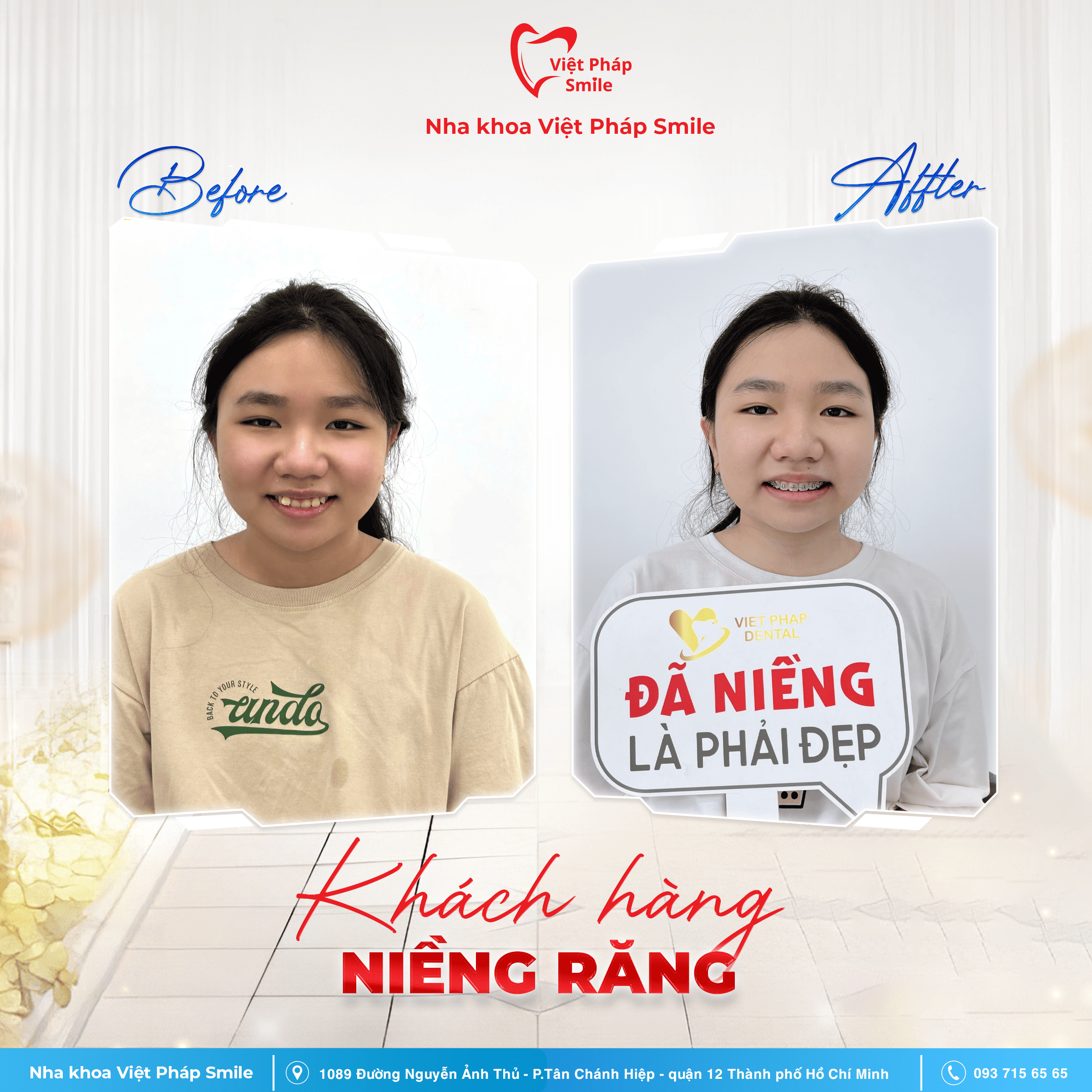 KHACH-HANG-NIENG-RANG-NHA-KHOA (3)