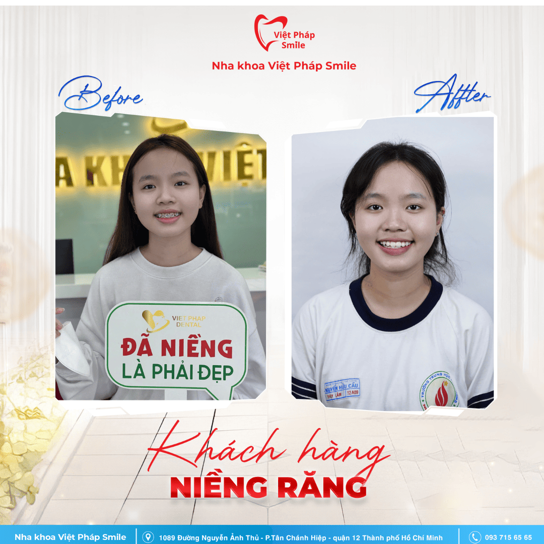 KHACH-HANG-NIENG-RANG-NHA-KHOA (10)