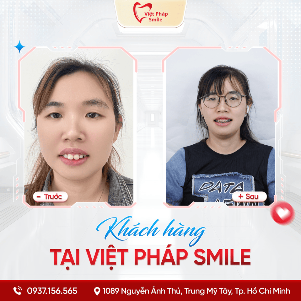 KHACH-HANG-NIENG-RANG-NHA-KHOA (11)