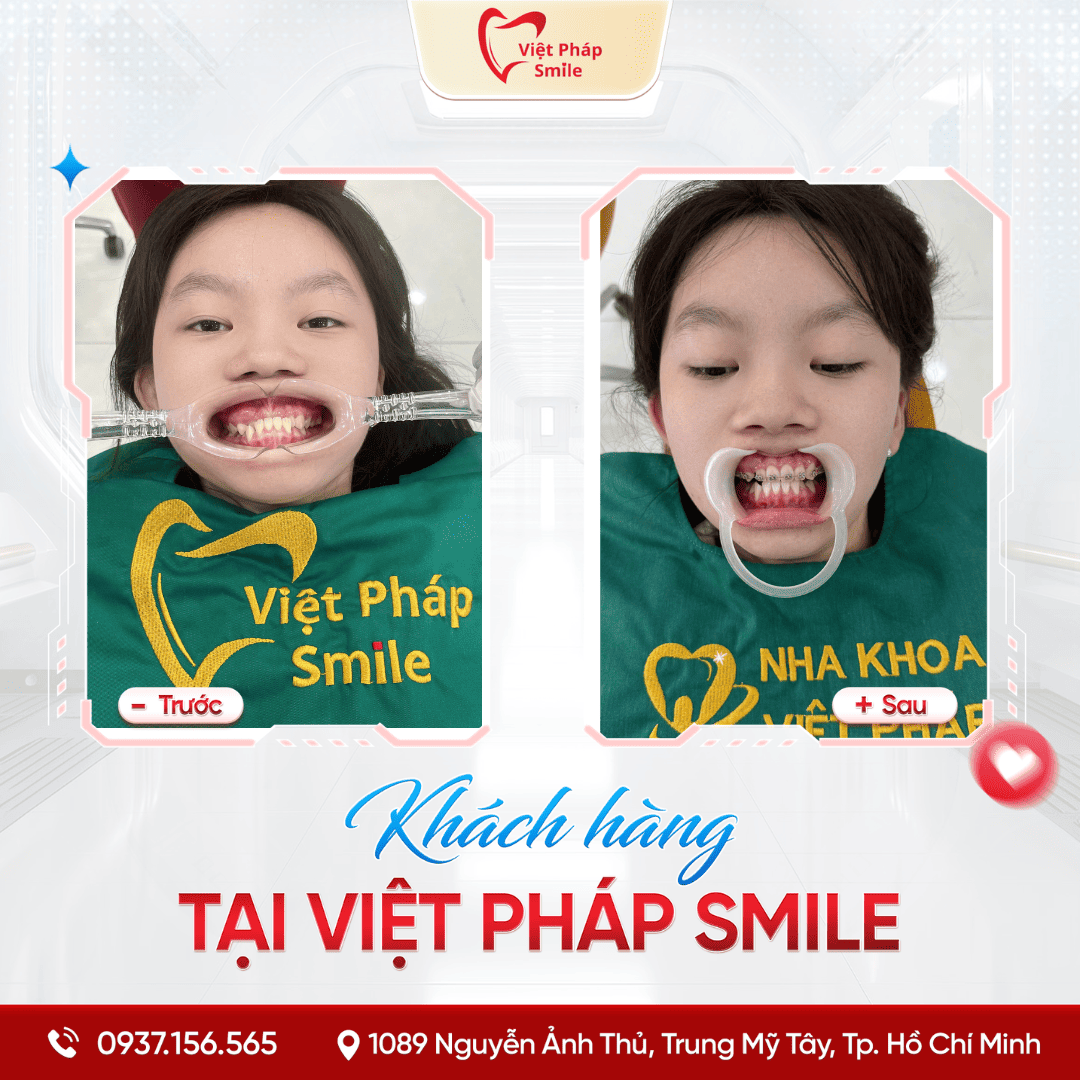 KHACH-HANG-NIENG-RANG-NHA-KHOA (12)