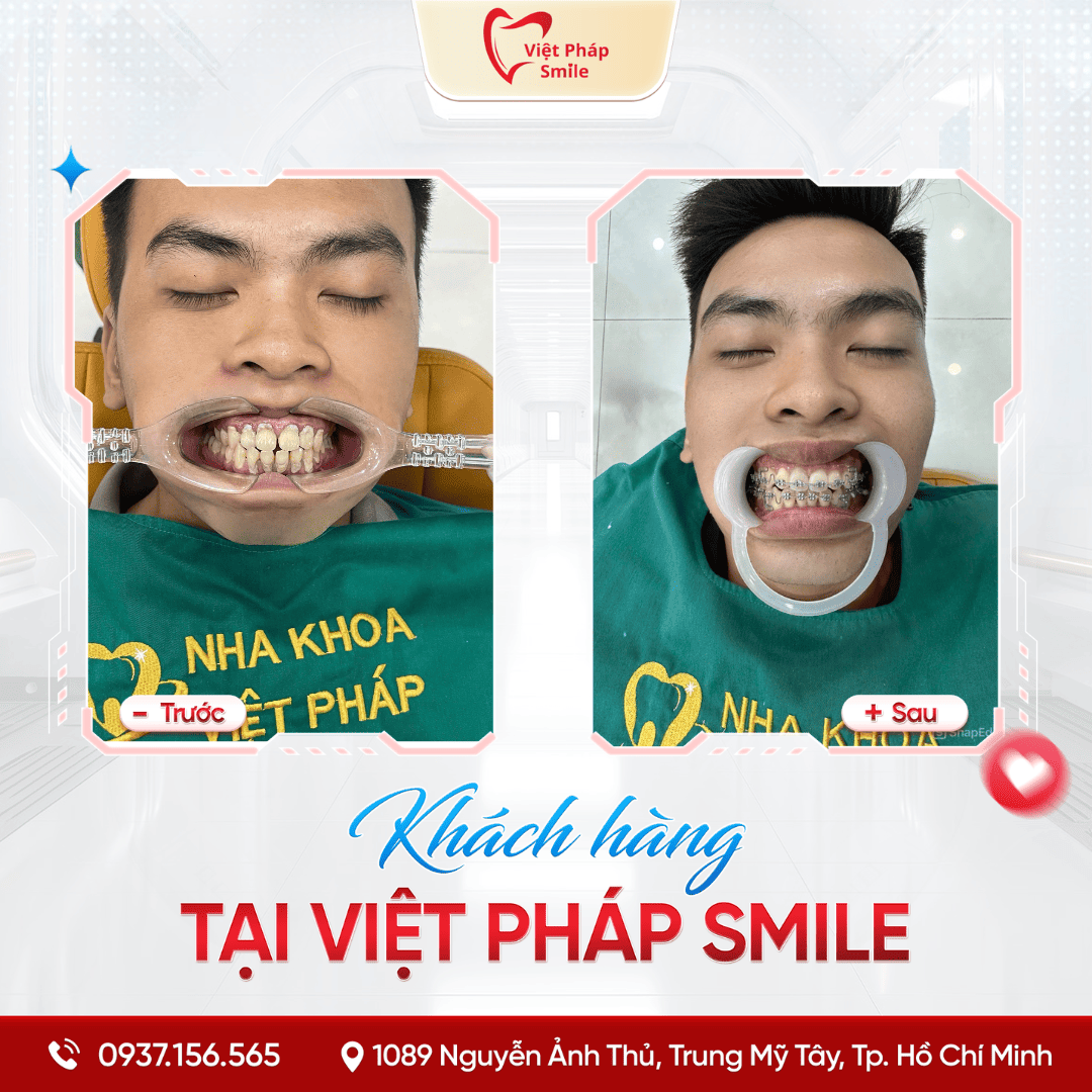 KHACH-HANG-NIENG-RANG-NHA-KHOA (13)