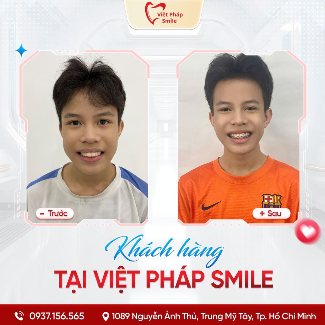 KHACH-HANG-NIENG-RANG-NHA-KHOA (2)