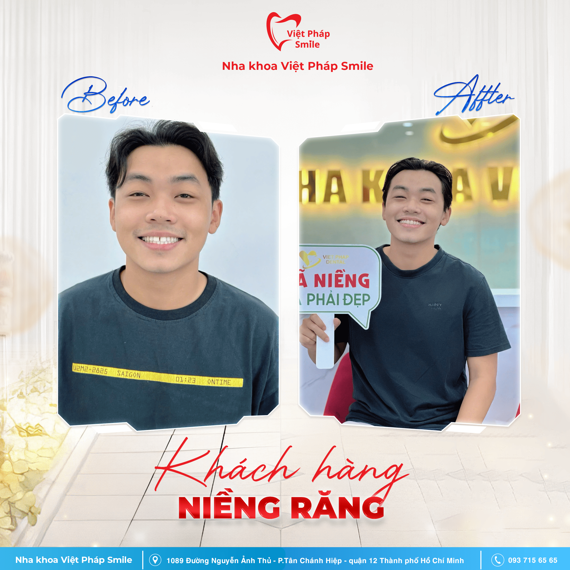 KHACH-HANG-NIENG-RANG-NHA-KHOA (2)