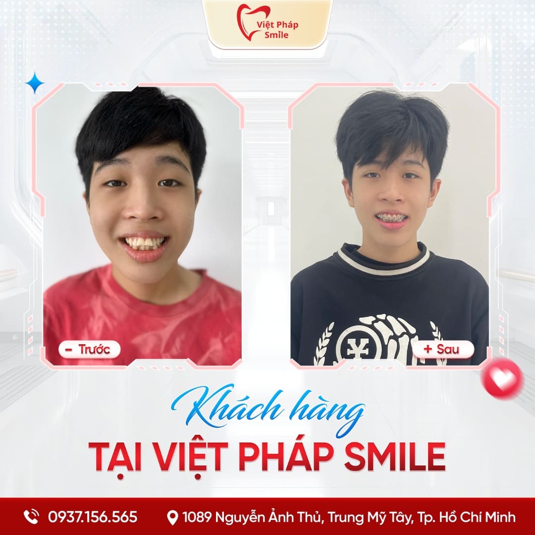 KHACH-HANG-NIENG-RANG-NHA-KHOA (3)