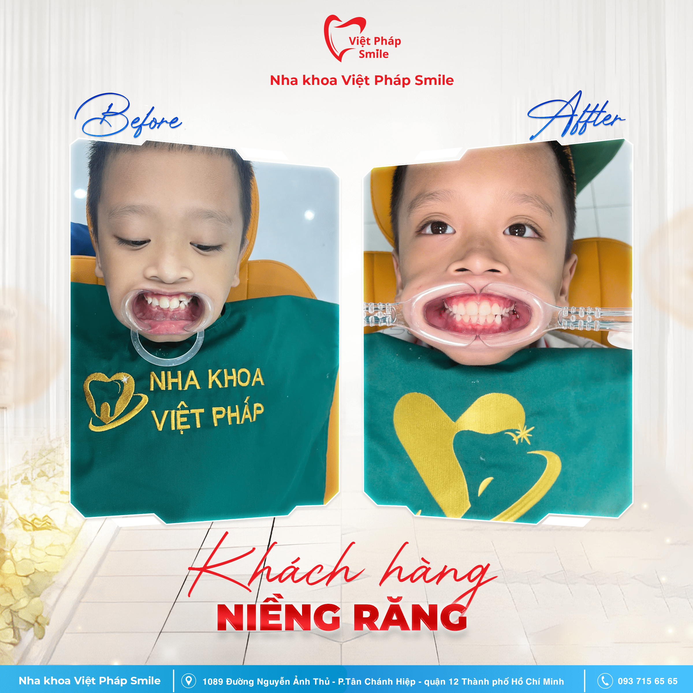KHACH-HANG-NIENG-RANG-NHA-KHOA (3)