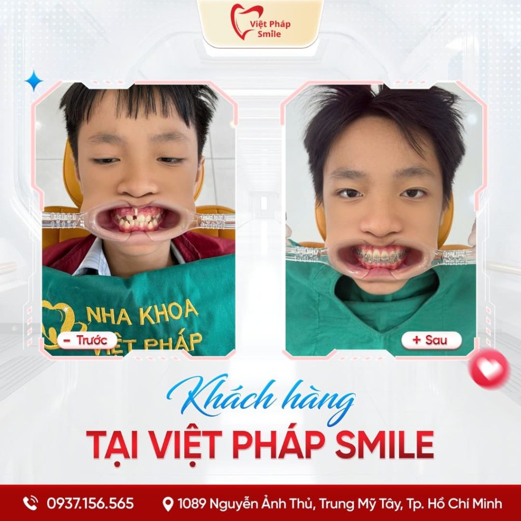 KHACH-HANG-NIENG-RANG-NHA-KHOA (4)