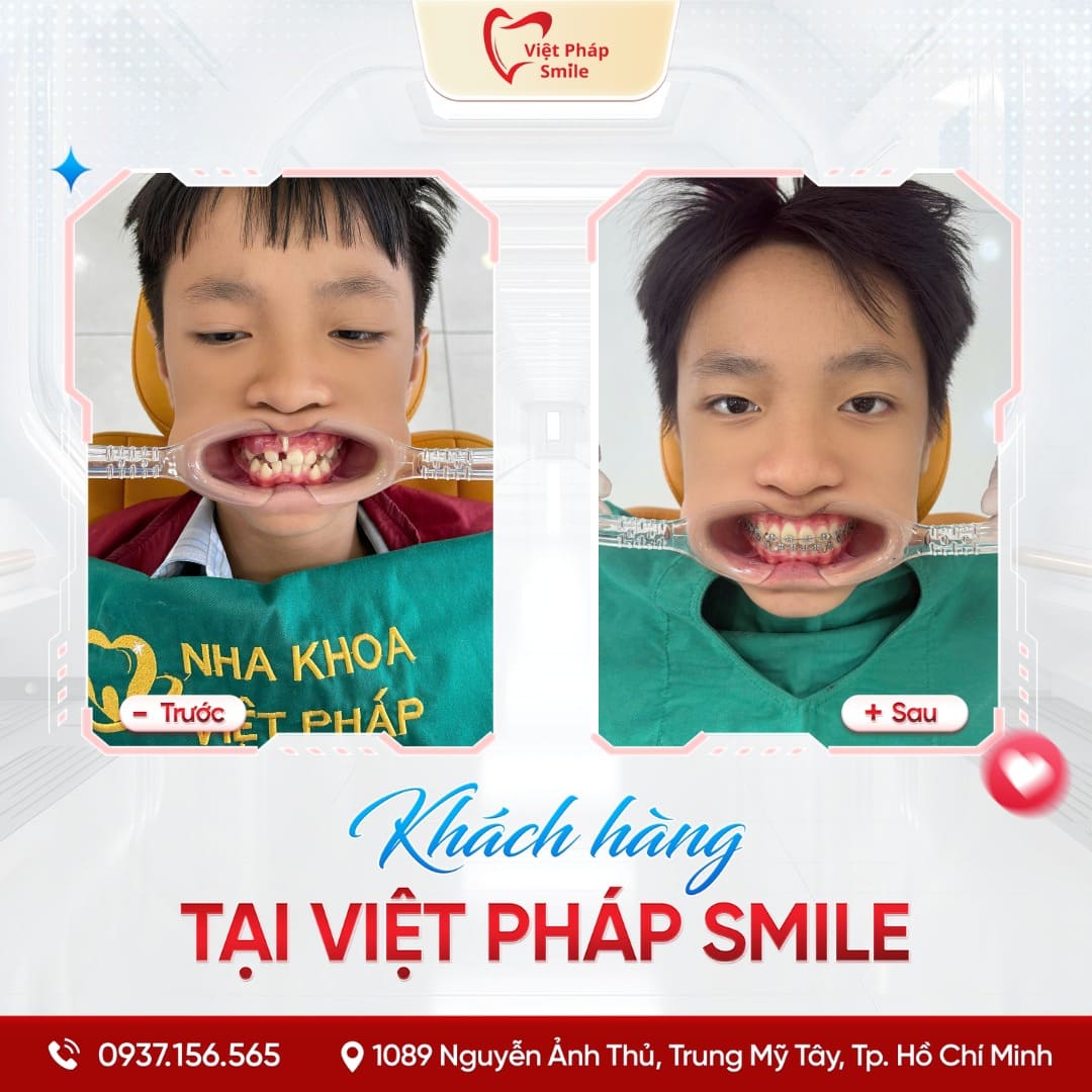 KHACH-HANG-NIENG-RANG-NHA-KHOA (4)