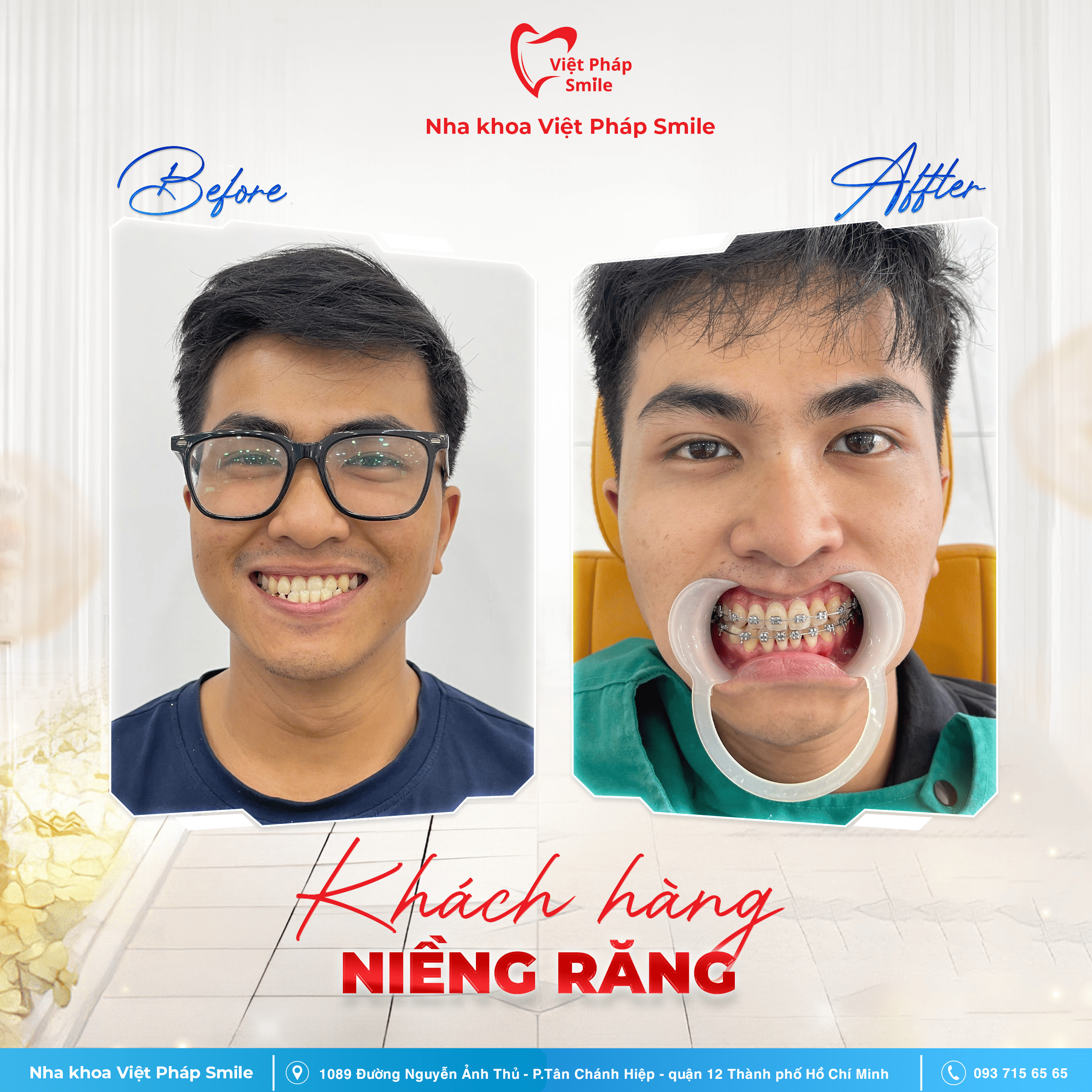 KHACH-HANG-NIENG-RANG-NHA-KHOA (4)