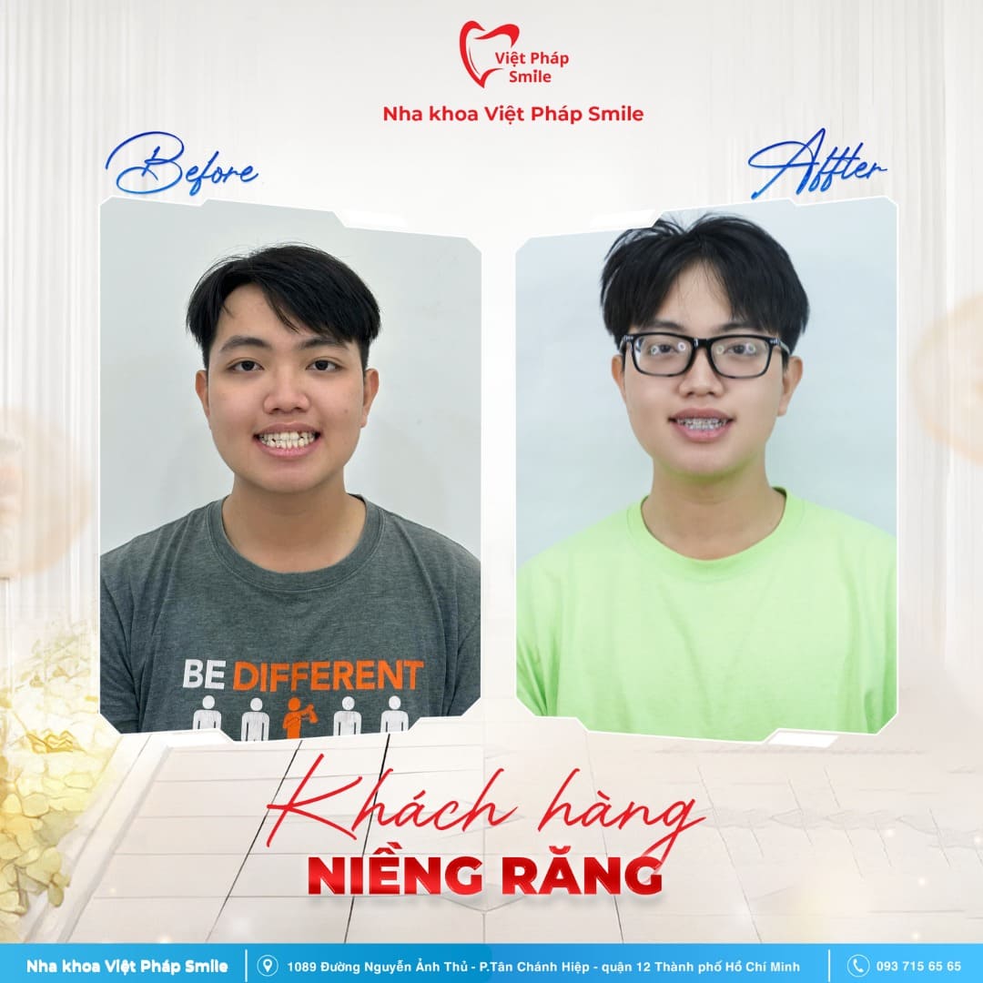 KHACH-HANG-NIENG-RANG-NHA-KHOA (5)