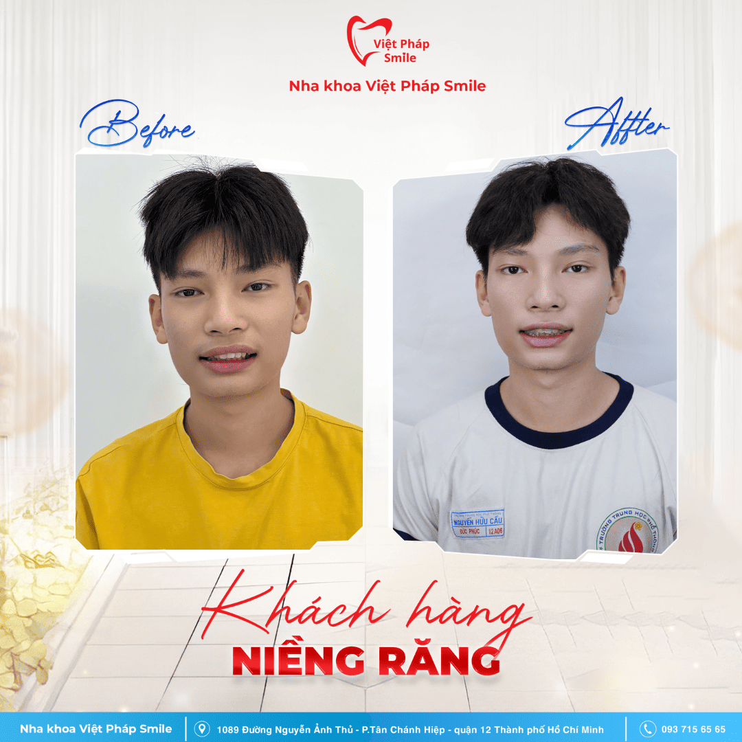 KHACH-HANG-NIENG-RANG-NHA-KHOA (5)