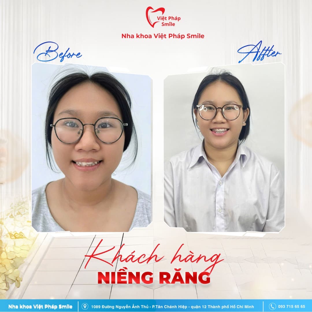 KHACH-HANG-NIENG-RANG-NHA-KHOA (6)