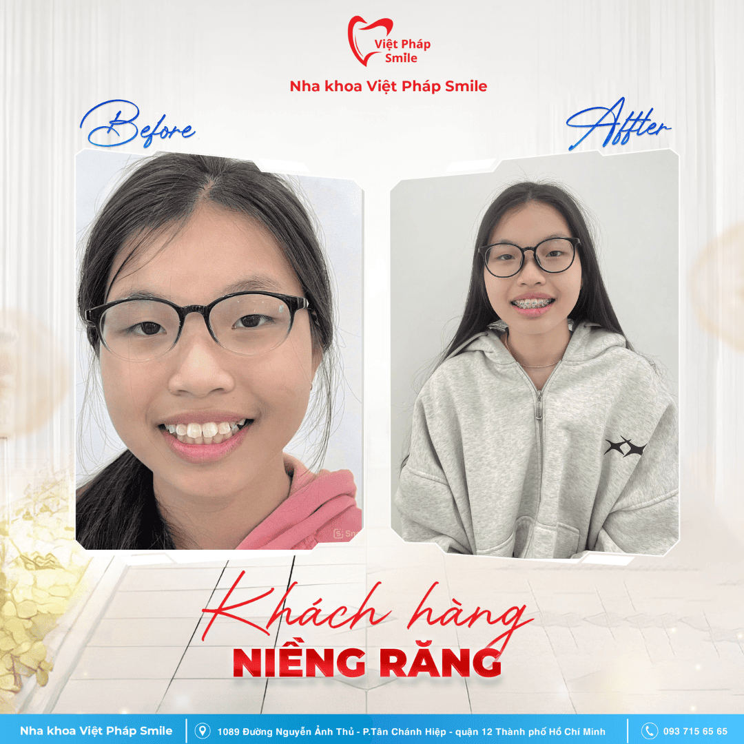 KHACH-HANG-NIENG-RANG-NHA-KHOA (6)