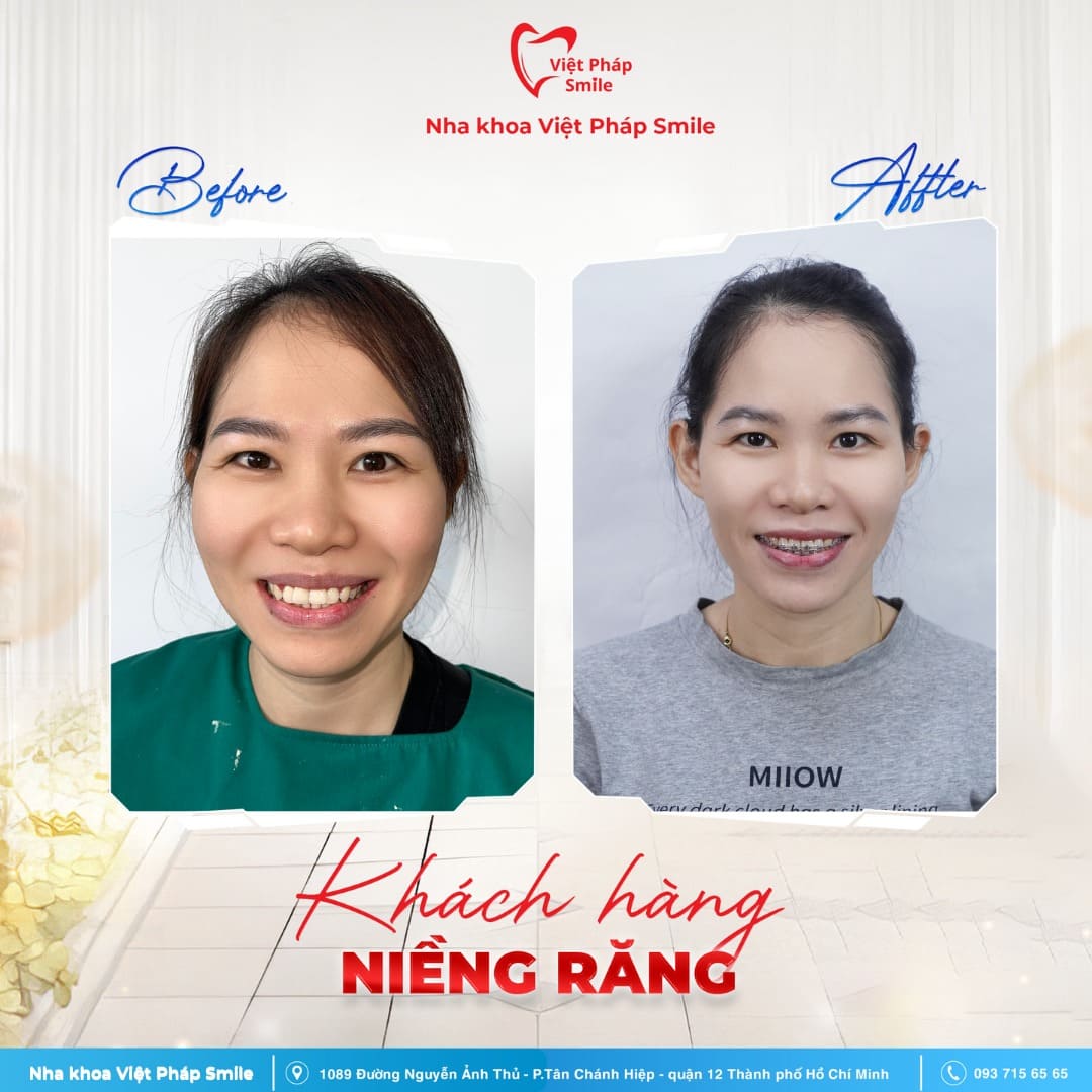 KHACH-HANG-NIENG-RANG-NHA-KHOA (7)