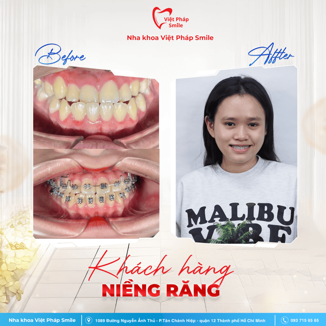 KHACH-HANG-NIENG-RANG-NHA-KHOA (7)