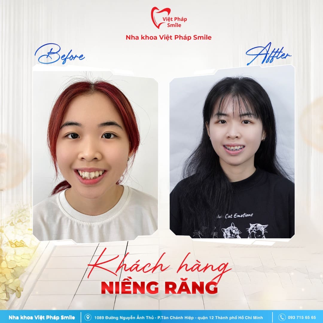 KHACH-HANG-NIENG-RANG-NHA-KHOA (8)