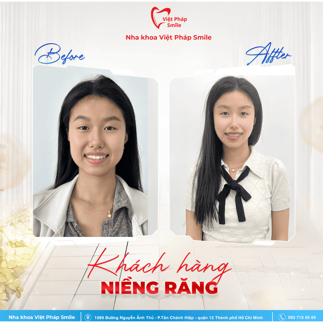 KHACH-HANG-NIENG-RANG-NHA-KHOA (8)