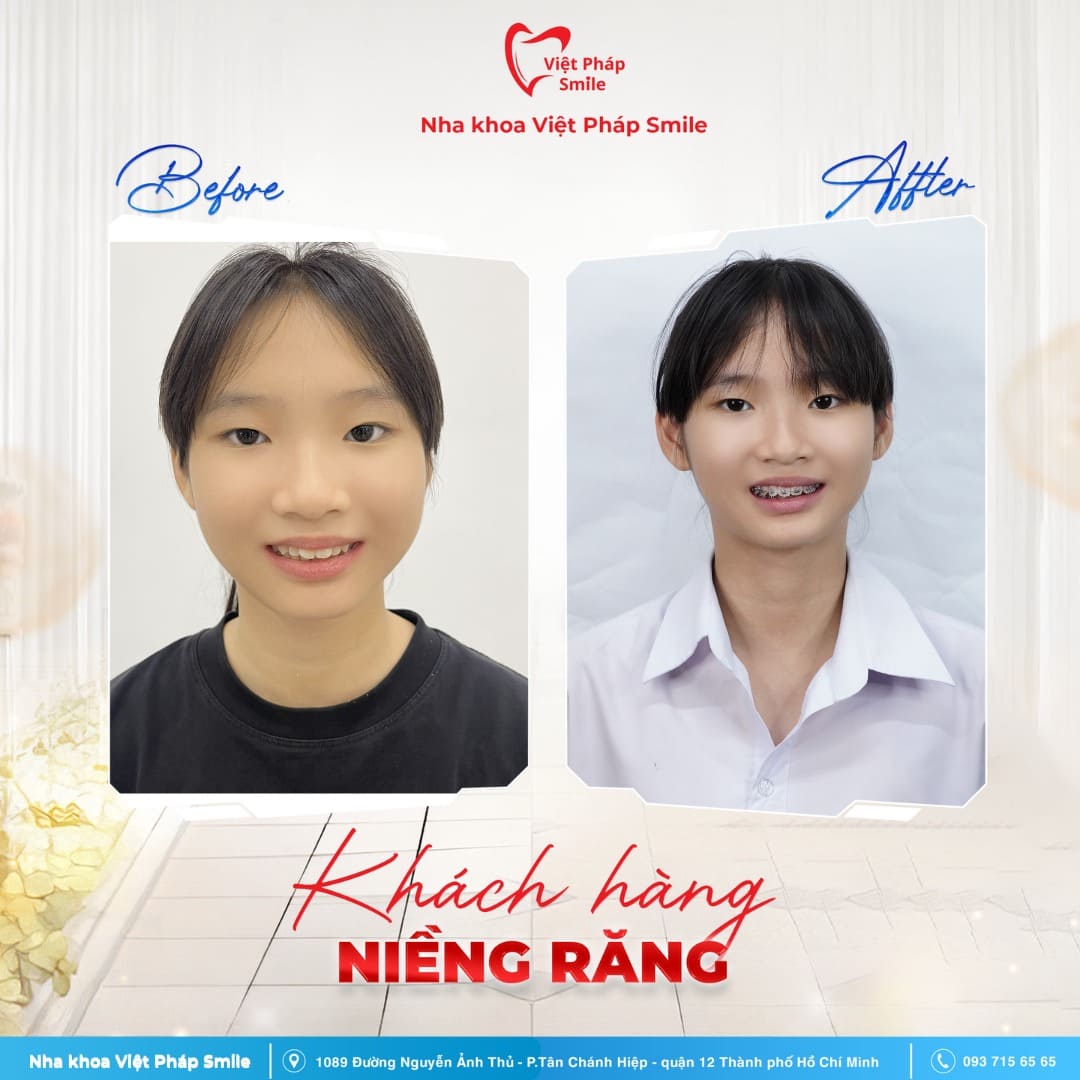 KHACH-HANG-NIENG-RANG-NHA-KHOA (9)