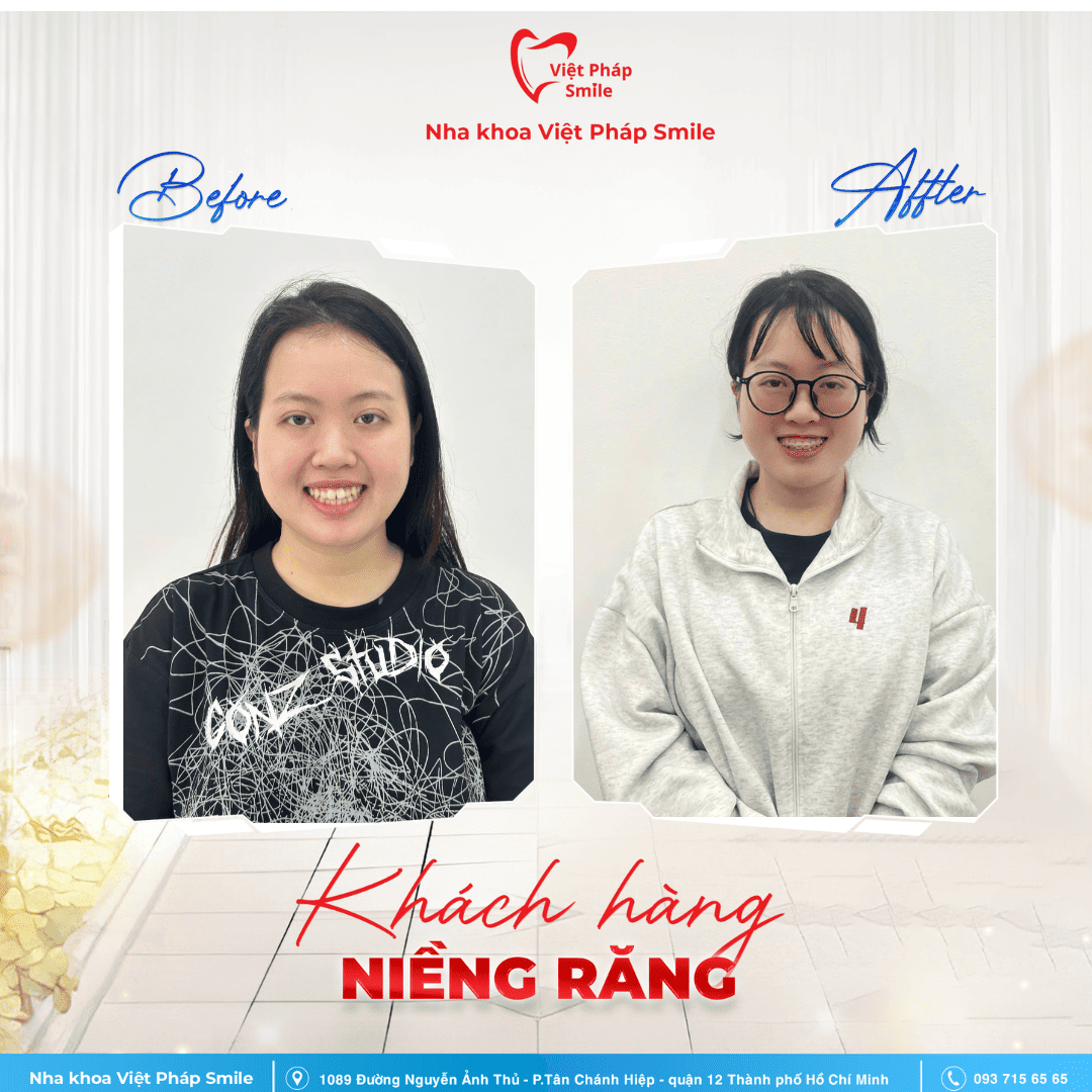 KHACH-HANG-NIENG-RANG-NHA-KHOA (9)