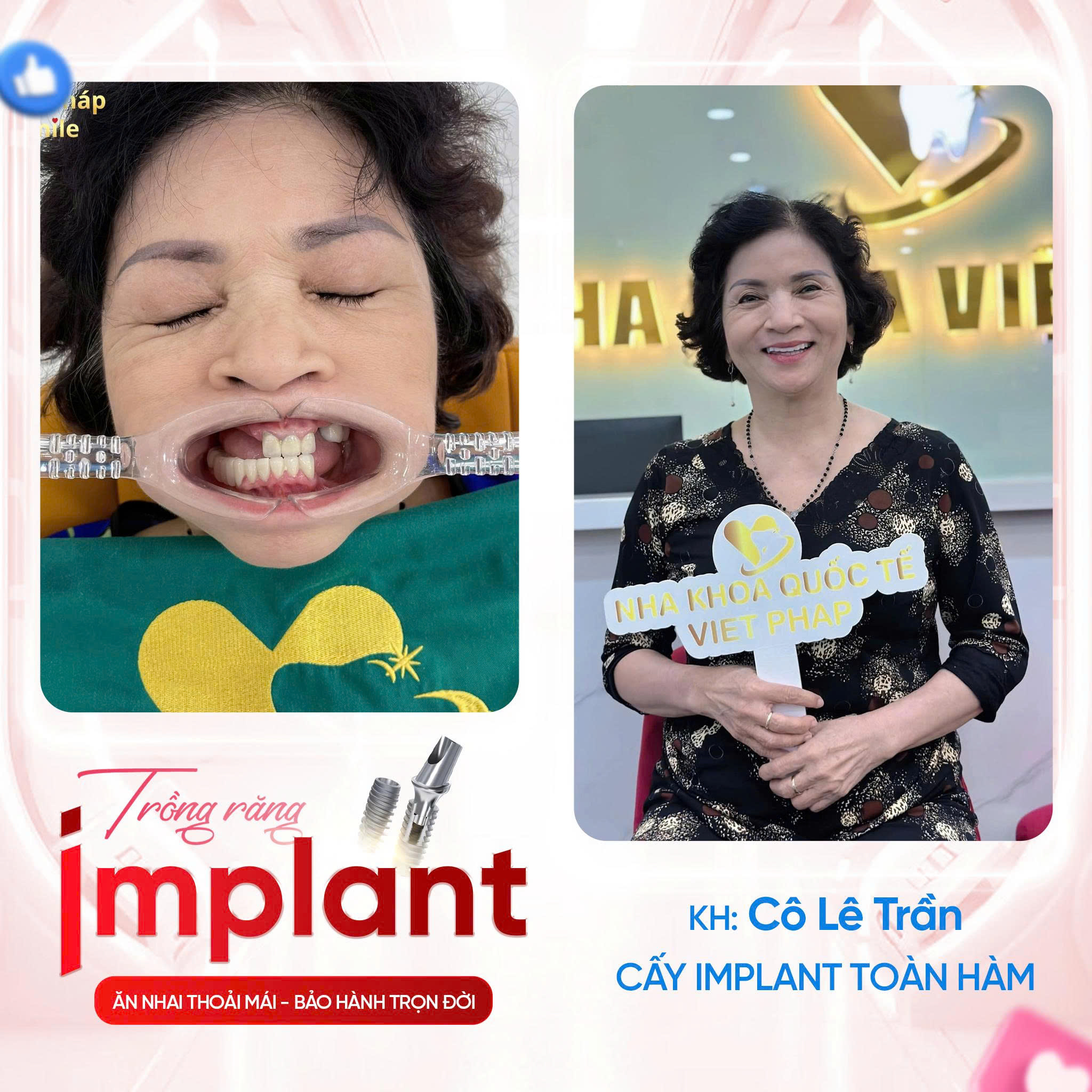 KHACH-HANG-TRONG-IMPLANT (1)