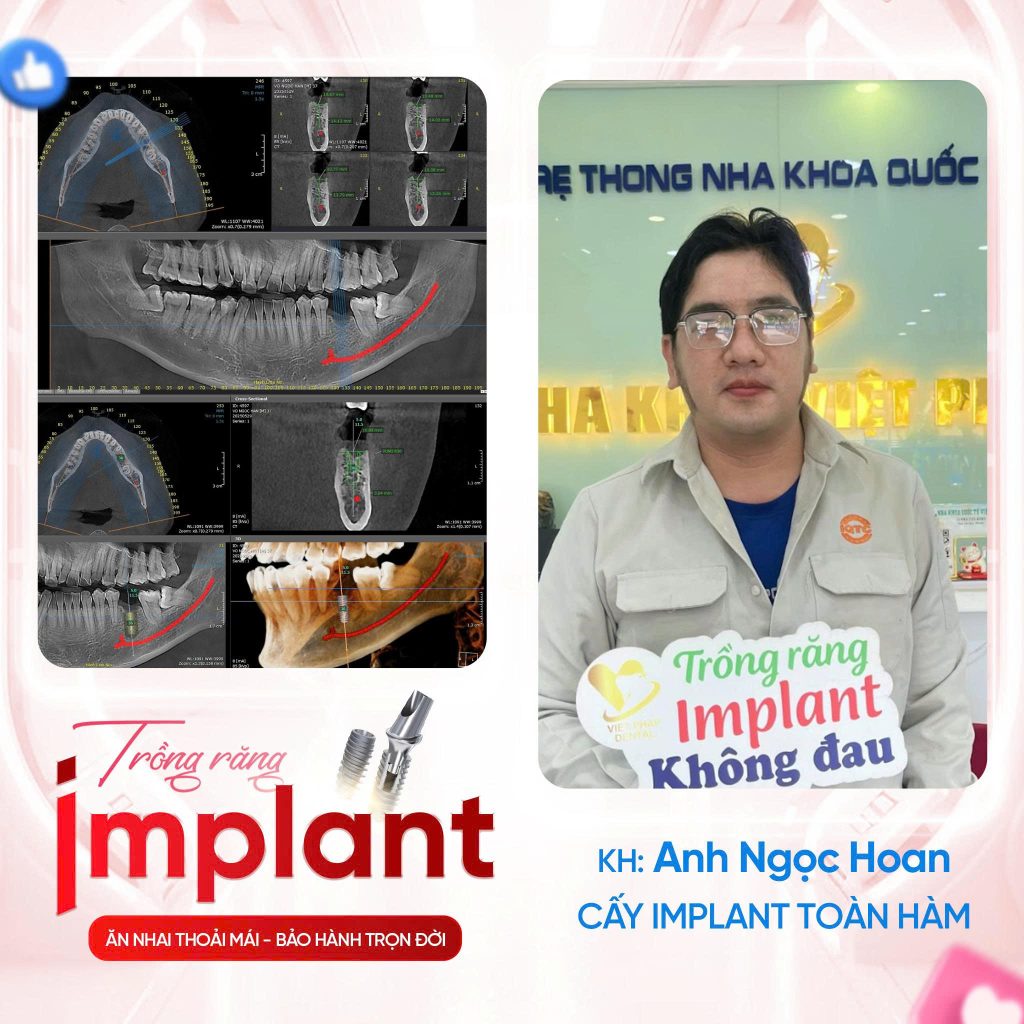 Top nha khoa uy tín tại TP.HCM được khách hàng đánh giá cao 4 KHACH-HANG-TRONG-IMPLANT (5)