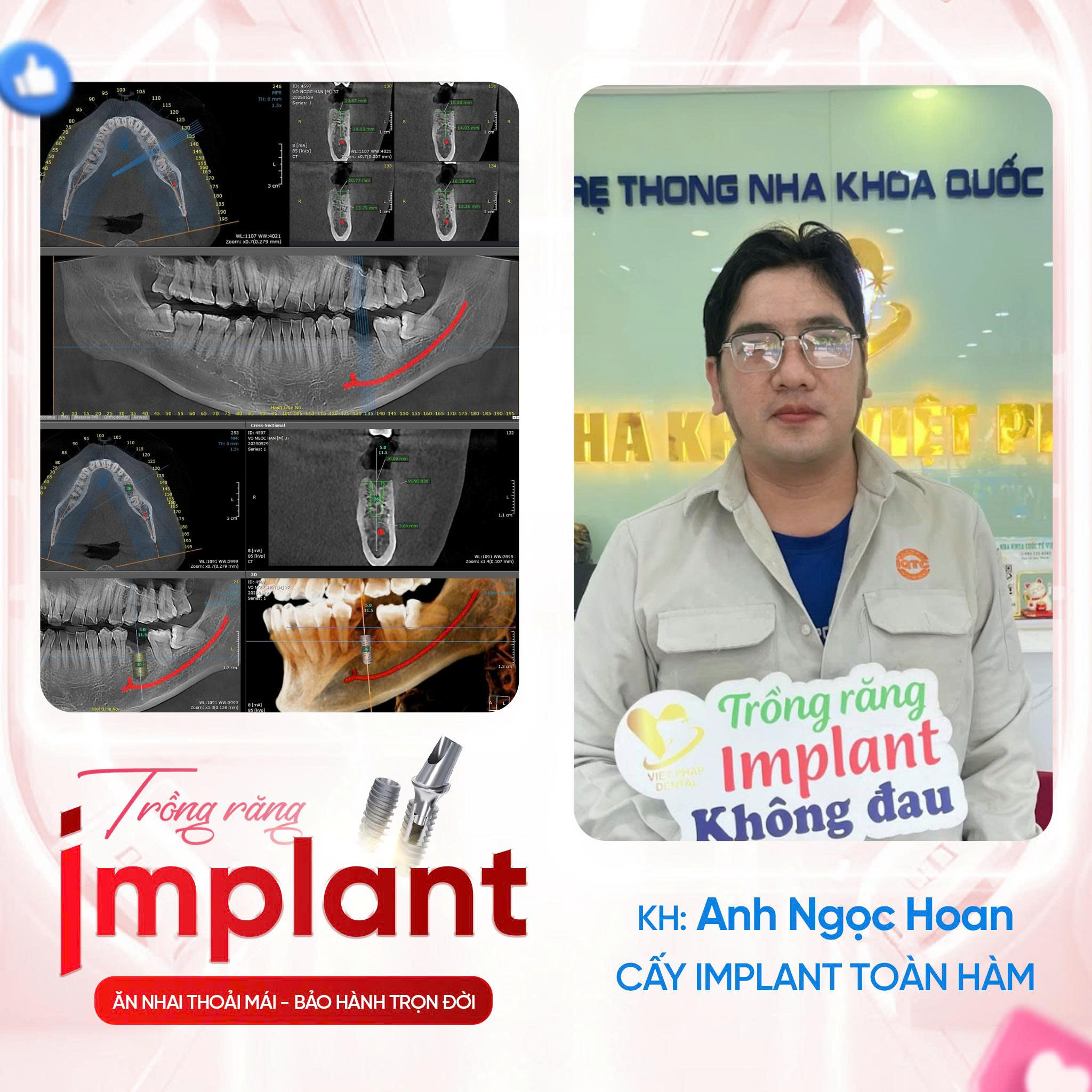 KHACH-HANG-TRONG-IMPLANT (5)