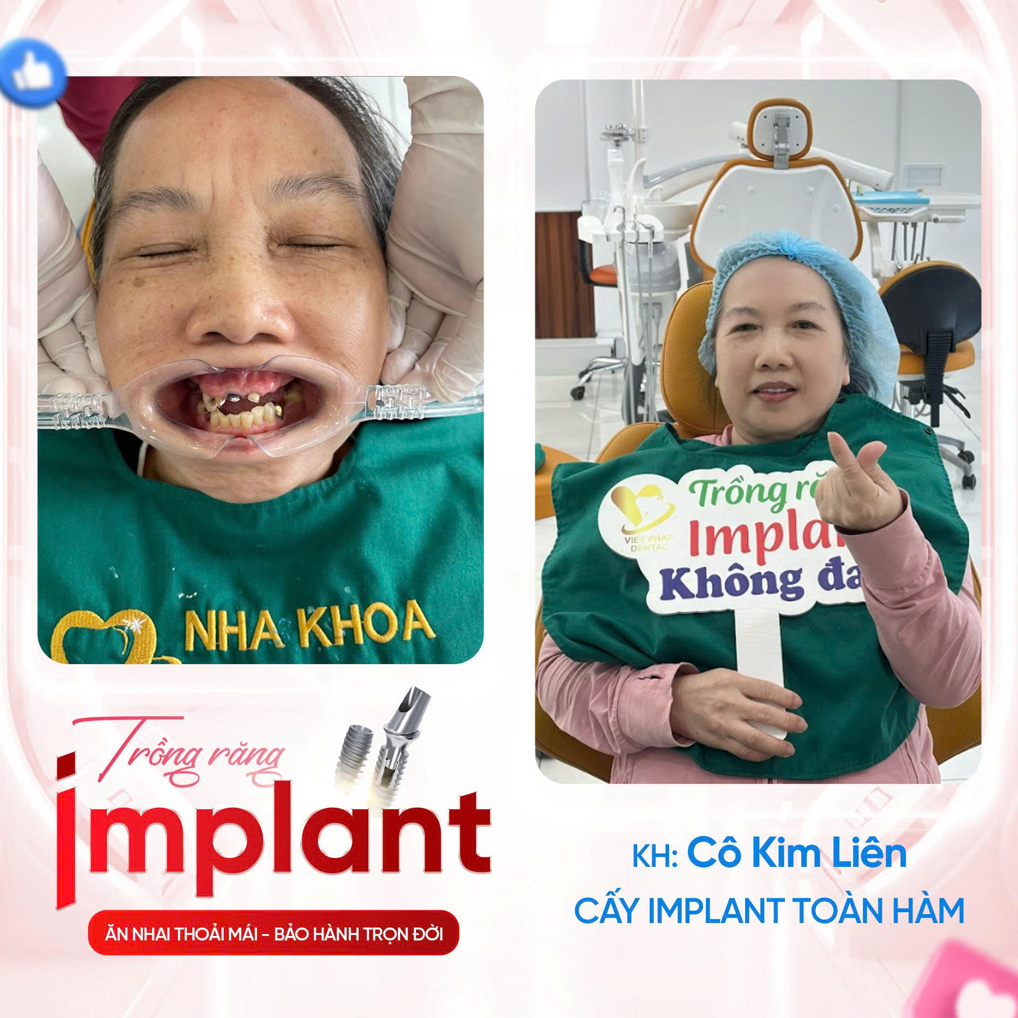 KHACH-HANG-TRONG-IMPLANT (7)